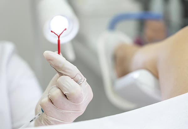 Aplicación de dispositivo intrauterino