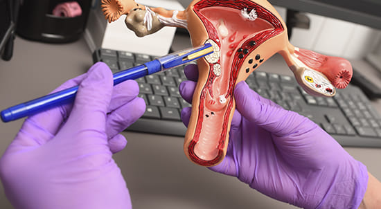 Histerectomía abdominal o vaginal